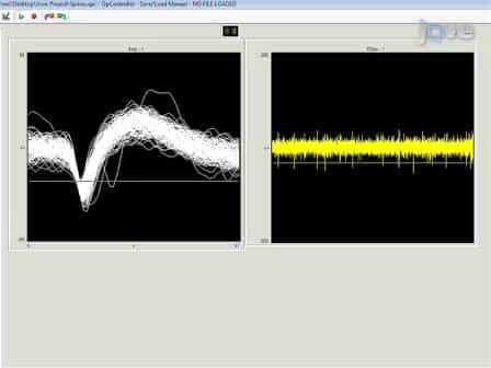 Surgical Implantation of Chronic Neural Electrodes for Recording Single Unit Activity and Electrocorticographic Signals