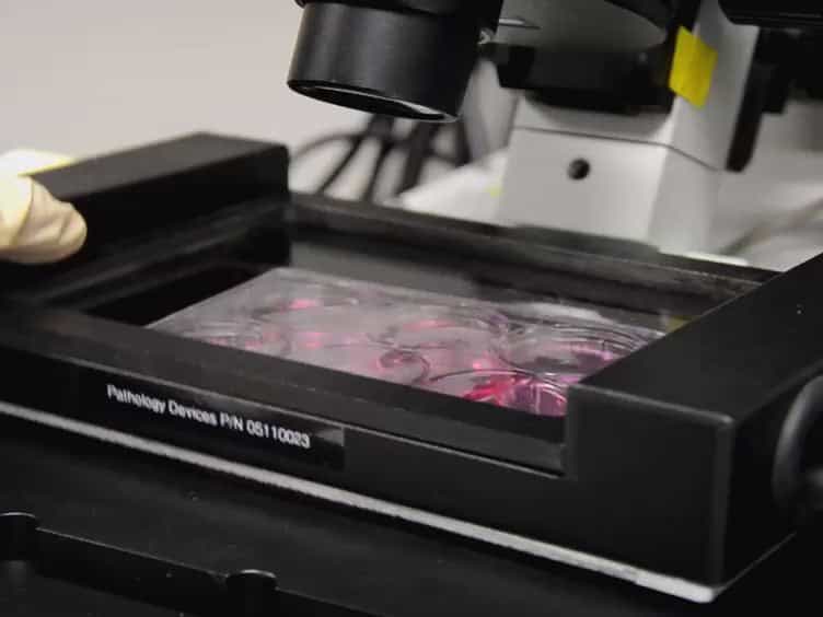 Quantitative Analysis of Random Migration of Cells Using Time-lapse Video Microscopy