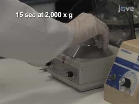 Amide Hydrogen/Deuterium Exchange & MALDI-TOF Mass Spectrometry Analysis of Pak2 Activation