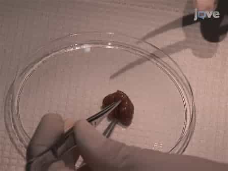 The CYP2D6 Animal Model: How to Induce Autoimmune Hepatitis in Mice