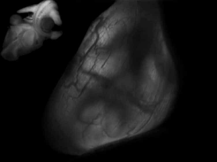 Gene Transfer to the Developing Mouse Inner Ear by In Vivo Electroporation