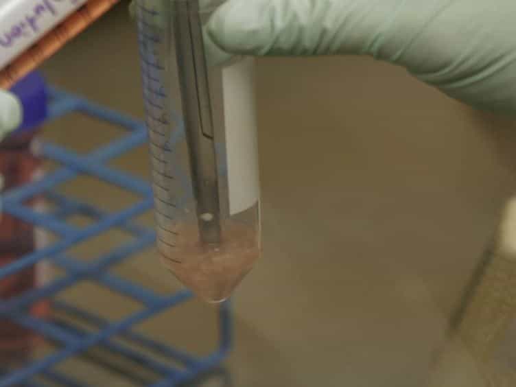 Isolation of Rat Portal Fibroblasts by In situ Liver Perfusion