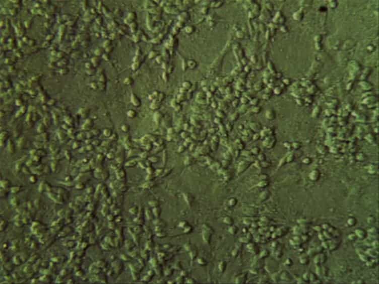 The Neuroblast Assay: An Assay for the Generation and Enrichment of Neuronal Progenitor Cells from Differentiating Neural Stem Cell Progeny Using Flow Cytometry