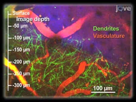 A Polished and Reinforced Thinned-skull Window for Long-term Imaging of the Mouse Brain