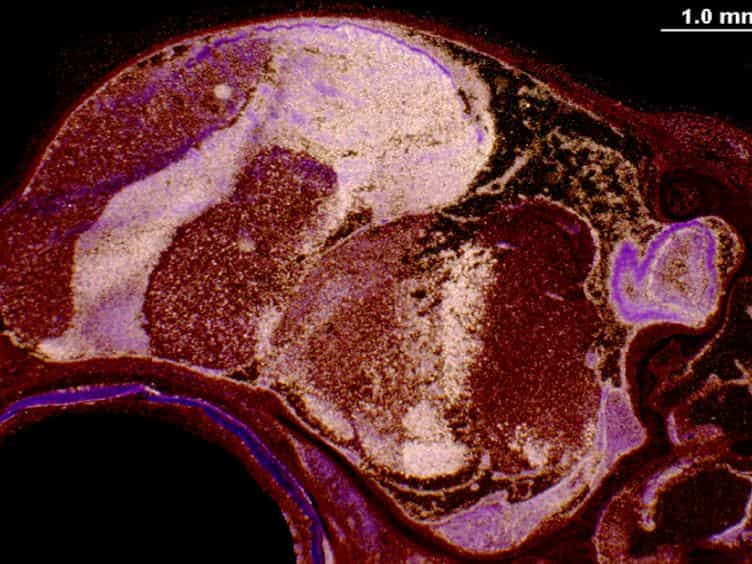 Radioactive in situ Hybridization for Detecting Diverse Gene Expression Patterns in Tissue