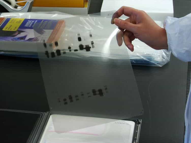 Isolation of Soluble and Insoluble PrP Oligomers in the Normal Human Brain