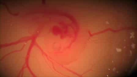In Ovo Electroporation in Embryonic Chick Retina