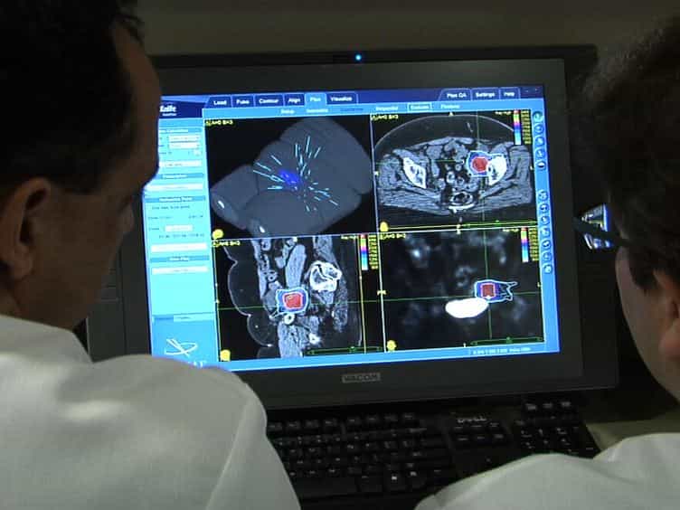 Stereotactic Radiosurgery for Gynecologic Cancer