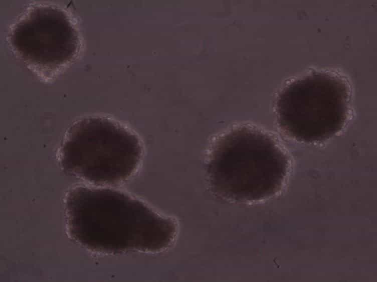 Efficient Differentiation of Mouse Embryonic Stem Cells into Motor Neurons