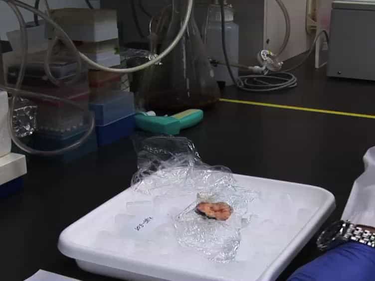 MicroRNA Detection in Prostate Tumors by Quantitative Real-time PCR qPCR