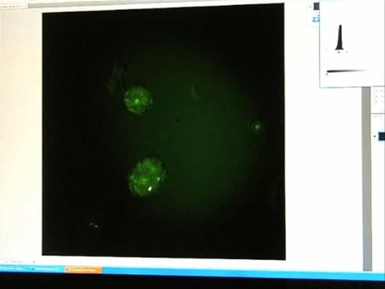 Identification and Isolation of Slow-Dividing Cells in Human Glioblastoma Using Carboxy Fluorescein Succinimidyl Ester CFSE