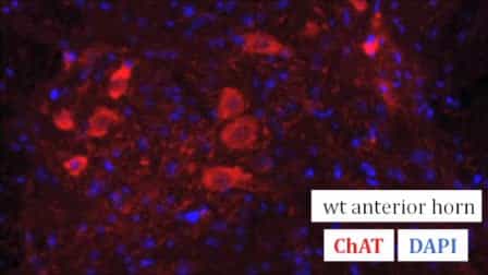 Clinical Testing and Spinal Cord Removal in a Mouse Model for Amyotrophic Lateral Sclerosis ALS