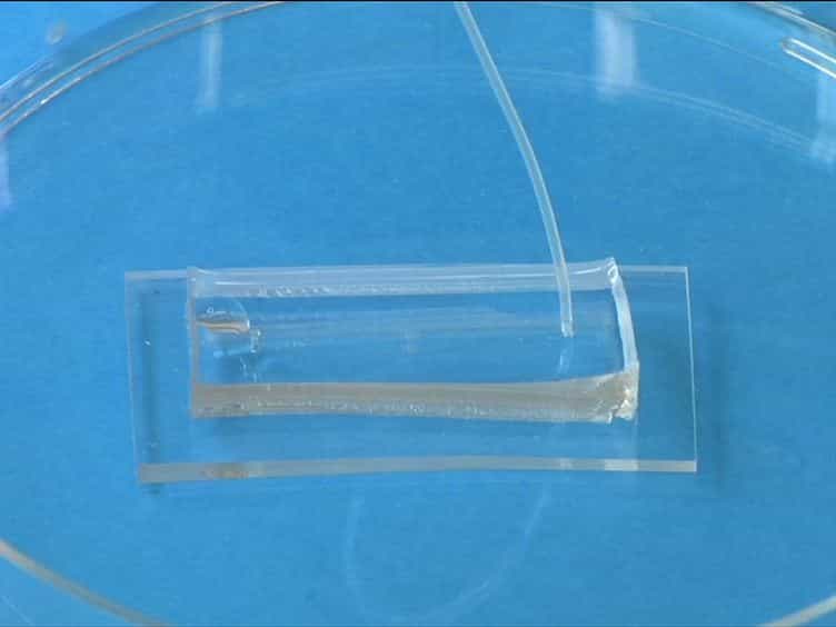 Endothelialized Microfluidics for Studying Microvascular Interactions in Hematologic Diseases