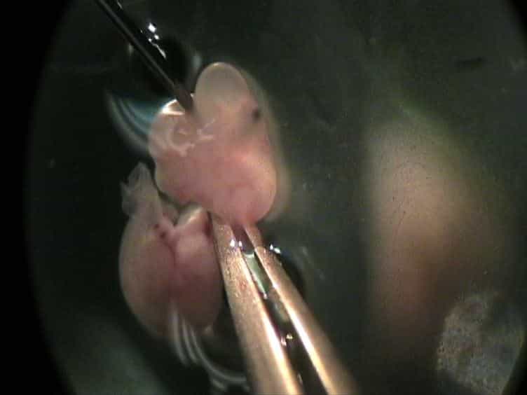 In vitro Electroporation of the Lower Rhombic Lip of Midgestation Mouse Embryos