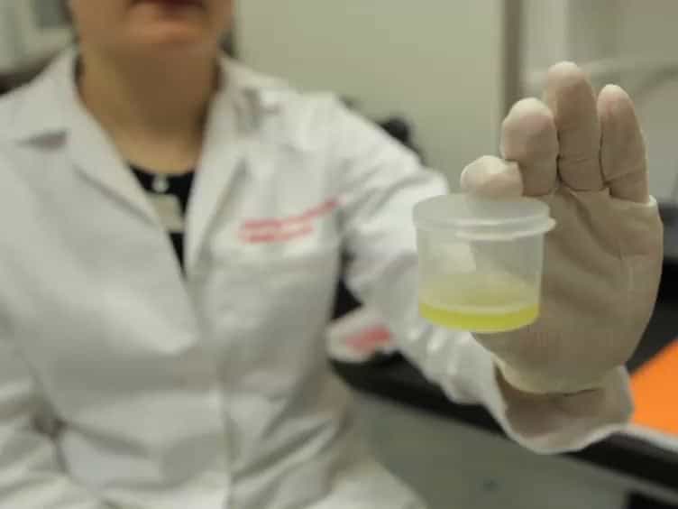 The &alpha;-test: Rapid Cell-free CD4 Enumeration Using Whole Saliva