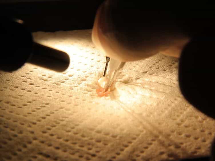Characterization of Molecular Mechanisms of In vivo UVR Induced Cataract