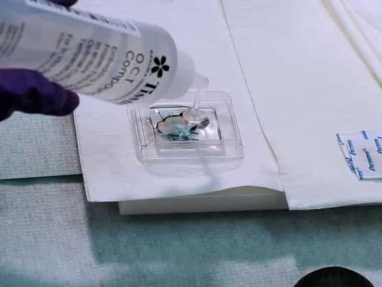 Collection Protocol for Human Pancreas