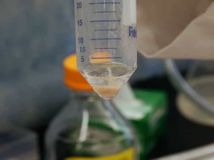Mouse Islet of Langerhans Isolation using a Combination of Purified Collagenase and Neutral Protease