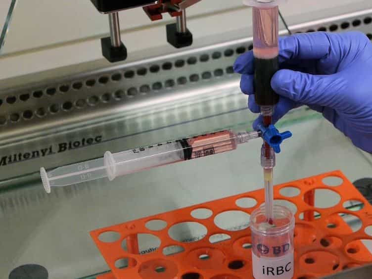 An In vitro Co-infection Model to Study Plasmodium falciparum-HIV-1 Interactions in Human Primary Monocyte-derived Immune Cells