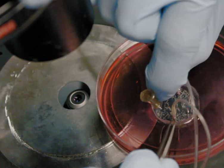 On-Chip Endothelial Inflammatory Phenotyping