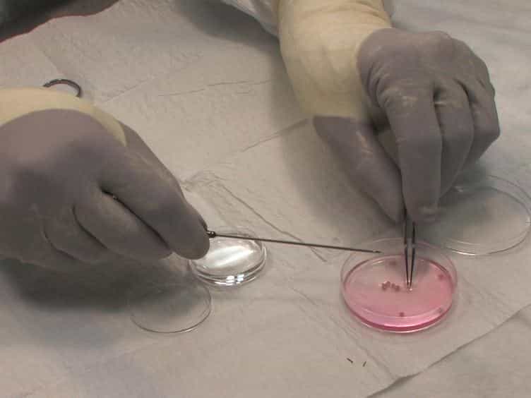 Using the BLT Humanized Mouse as a Stem Cell based Gene Therapy Tumor Model