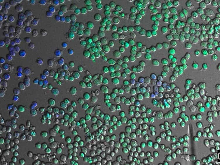 Visualization of Bacterial Toxin Induced Responses Using Live Cell Fluorescence Microscopy