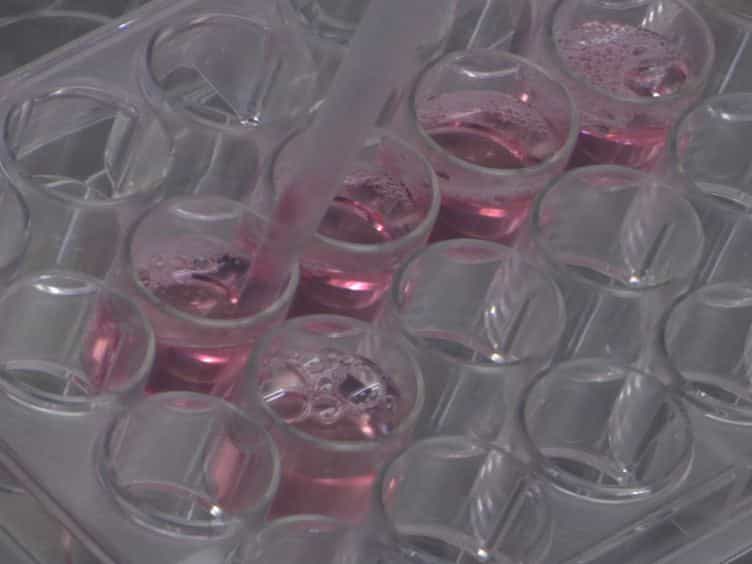 piggyBac Transposon System Modification of Primary Human T Cells