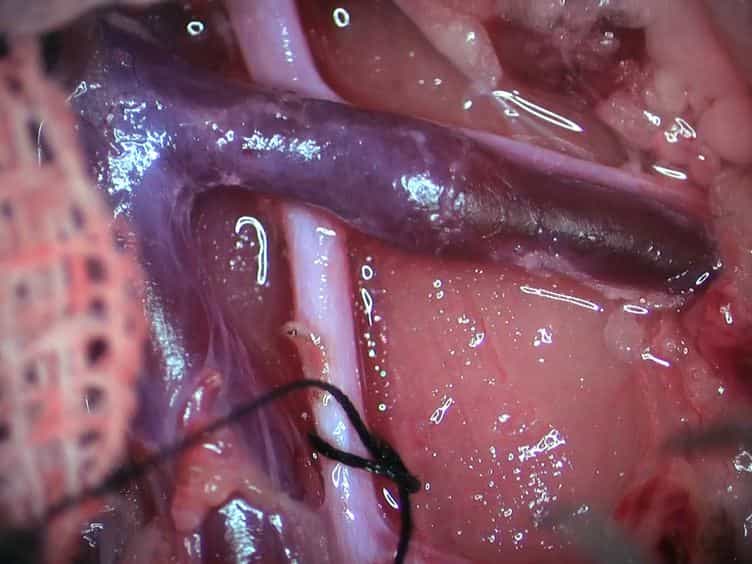 Non-invasive Imaging of Acute Allograft Rejection after Rat Renal Transplantation Using 18F-FDG PET