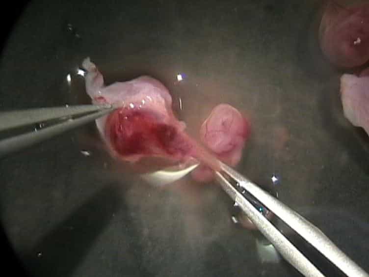 Use of LysoTracker to Detect Programmed Cell Death in Embryos and Differentiating Embryonic Stem Cells