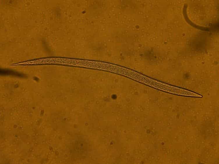 Visualizing Bacteria in Nematodes using Fluorescent Microscopy