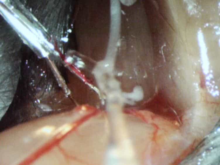 Simultaneous Intracellular Recording of a Lumbar Motoneuron and the Force Produced by its Motor Unit in the Adult Mouse In vivo