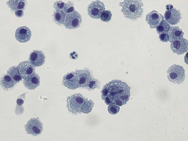 Bronchoalveolar Lavage (BAL) for Research; Obtaining Adequate Sample Yield