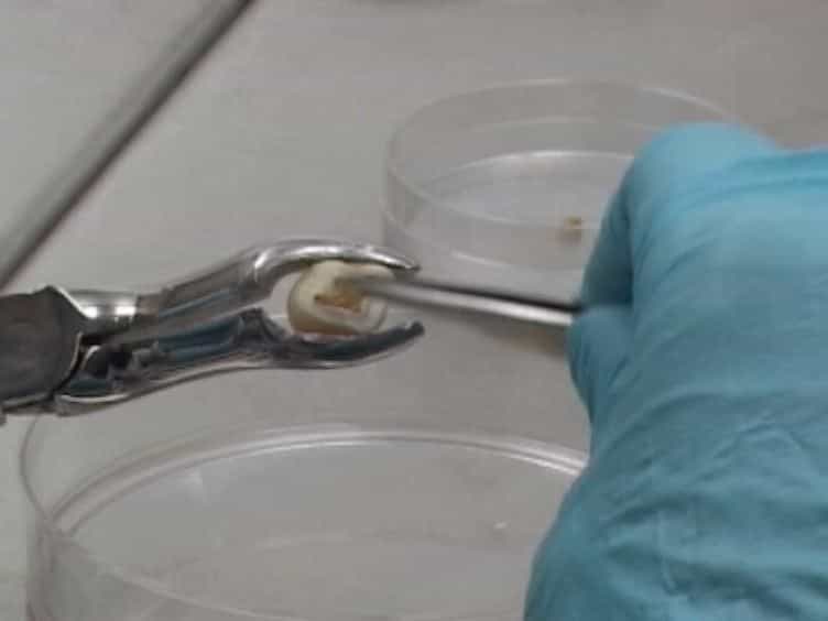Isolation, Characterization and Comparative Differentiation of Human Dental Pulp Stem Cells Derived from Permanent Teeth by Using Two Different Methods