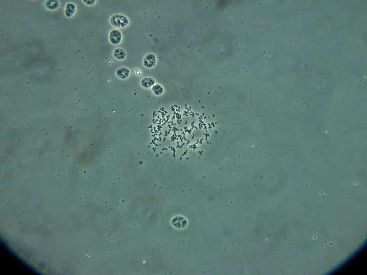 Chromosome Replicating Timing Combined with Fluorescent In situ Hybridization