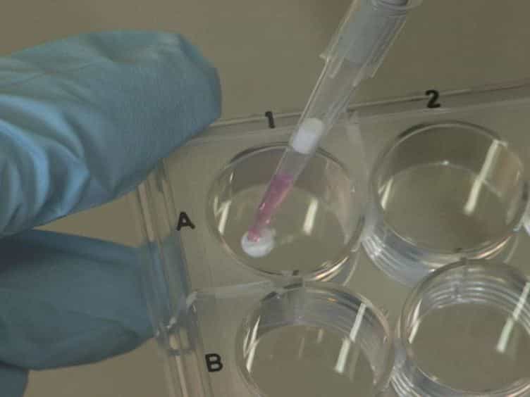 Matrix-assisted Autologous Chondrocyte Transplantation for Remodeling and Repair of Chondral Defects in a Rabbit Model