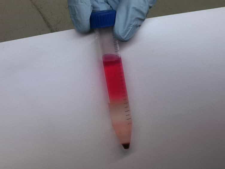 Treatment of Osteochondral Defects in the Rabbit's Knee Joint by Implantation of Allogeneic Mesenchymal Stem Cells in Fibrin Clots