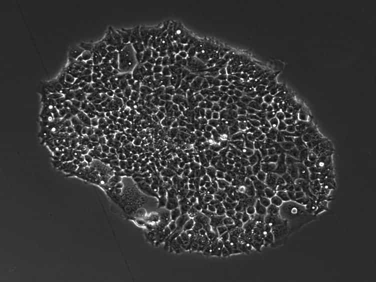 Preparation of Cell-lines for Conditional Knockdown of Gene Expression and Measurement of the Knockdown Effects on E4orf4-Induced Cell Death
