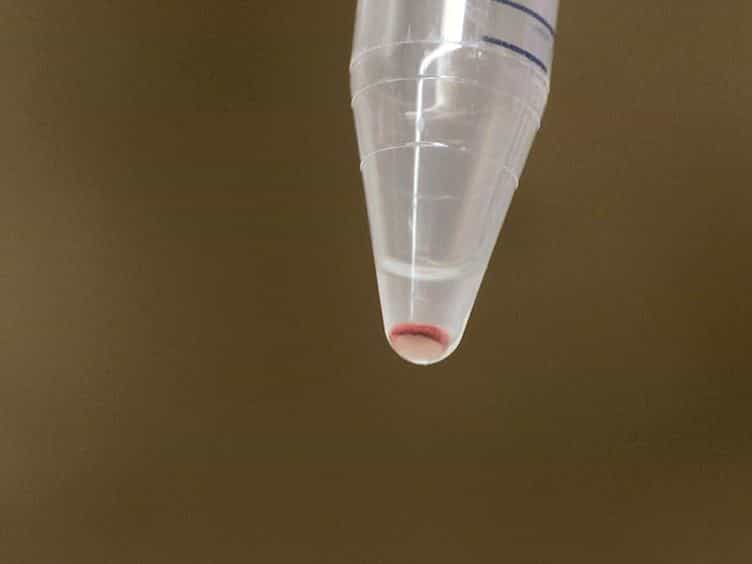 Trans-vivo Delayed Type Hypersensitivity Assay for Antigen Specific Regulation