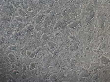 Freezing Human ES Cells