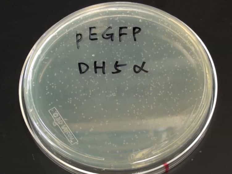 Skin Tattooing As A Novel Approach For DNA Vaccine Delivery