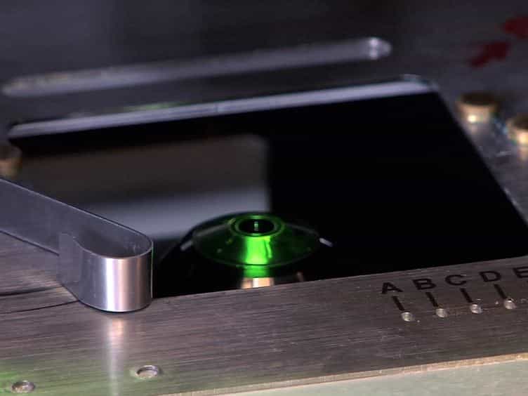 Quantitative Analysis of Autophagy using Advanced 3D Fluorescence Microscopy