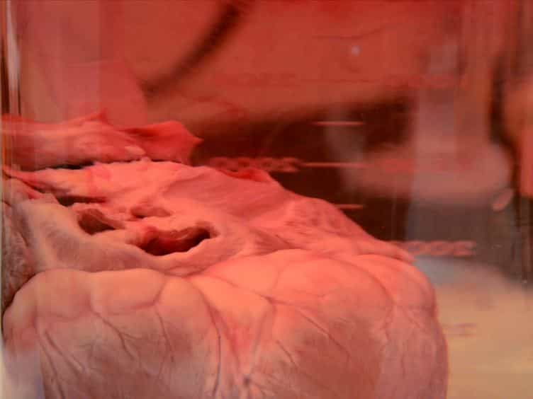 Procedure for Decellularization of Porcine Heart by Retrograde Coronary Perfusion