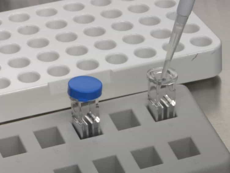 Clinical Application of Sleeping Beauty and Artificial Antigen Presenting Cells to Genetically Modify T Cells from Peripheral and Umbilical Cord Blood