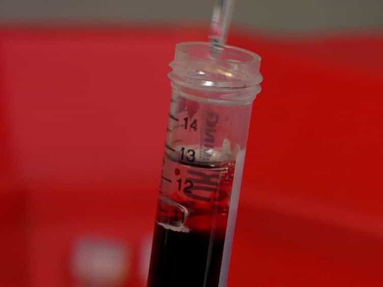 Staphylococcus aureus Growth using Human Hemoglobin as an Iron Source