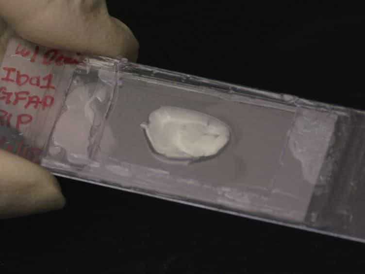 Intact Histological Characterization of Brain-implanted Microdevices and Surrounding Tissue