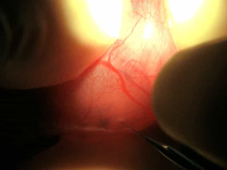 Generation of Topically Transgenic Rats by In utero Electroporation and In vivo Bioluminescence Screening