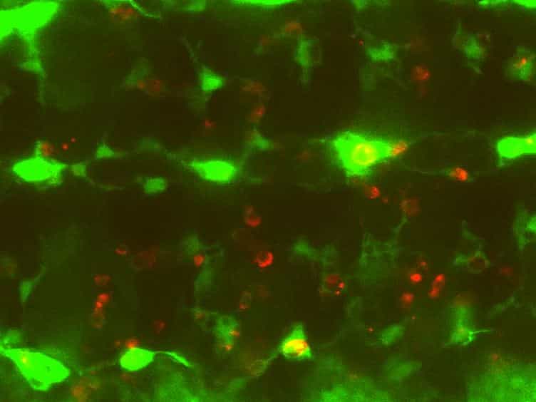 Live Imaging of Apoptotic Cell Clearance during Drosophila Embryogenesis