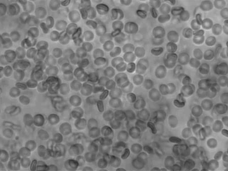 Ex Vivo Red Blood Cell Hemolysis Assay for the Evaluation of pH-responsive Endosomolytic Agents for Cytosolic Delivery of Biomacromolecular Drugs