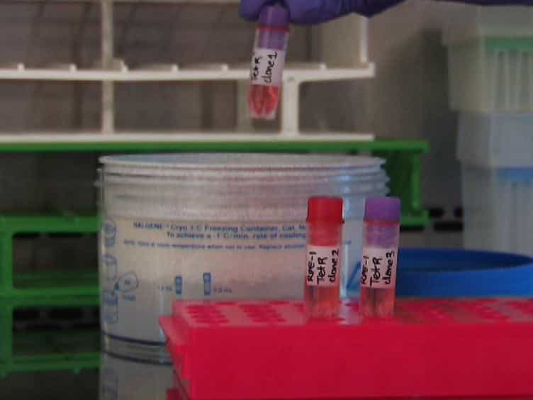Generation of Stable Human Cell Lines with Tetracycline-inducible (Tet-on) shRNA or cDNA Expression