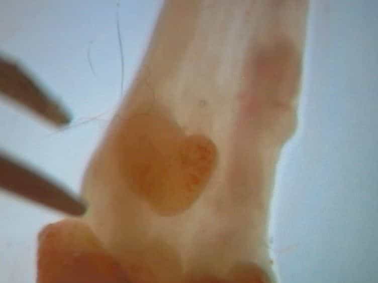 In vitro Organoid Culture of Primary Mouse Colon Tumors